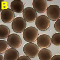 Microgametophyte Picture